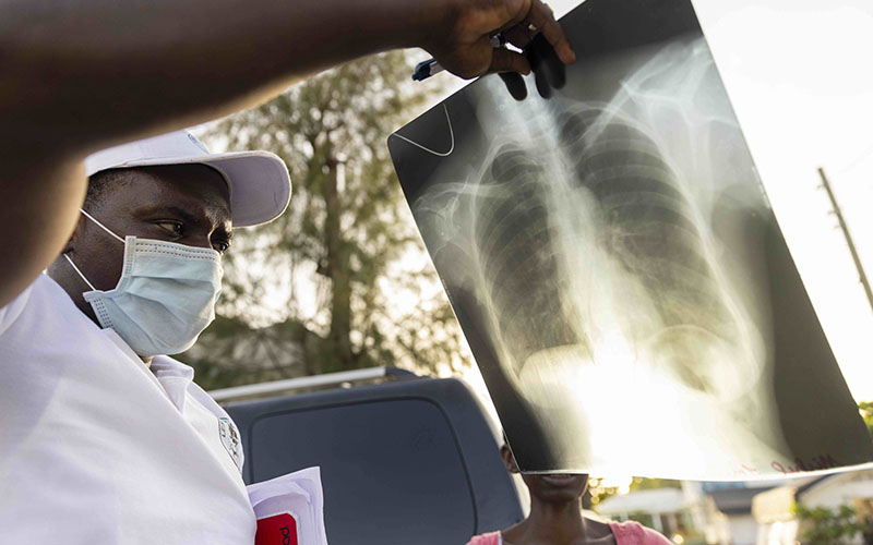 Doctor looking at an x-ray at the GHESKIO Centers